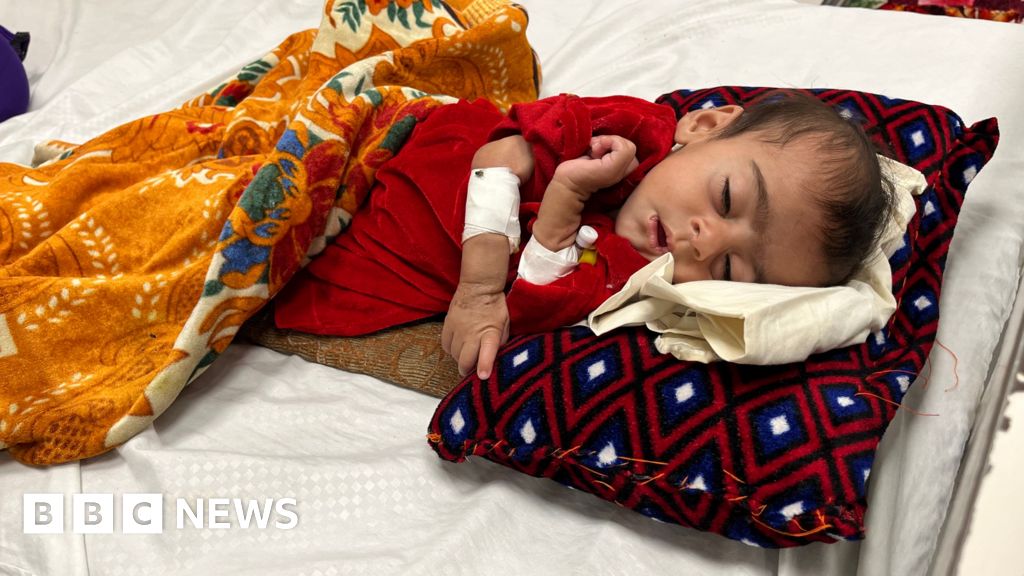 Babies dying as malnutrition disaster unfolds